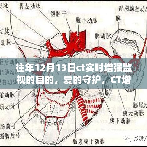 愛的守護(hù)，CT增強(qiáng)監(jiān)視下的暖心故事與實(shí)時(shí)增強(qiáng)監(jiān)視目的揭秘