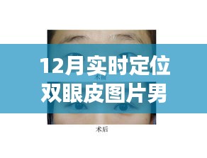 雙眼皮蛻變之旅，從學(xué)習(xí)到自信的華麗轉(zhuǎn)身，實(shí)時(shí)定位雙眼皮圖片男展示十二月的蛻變歷程