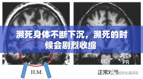 瀕死身體不斷下沉，瀕死的時候會劇烈收縮 