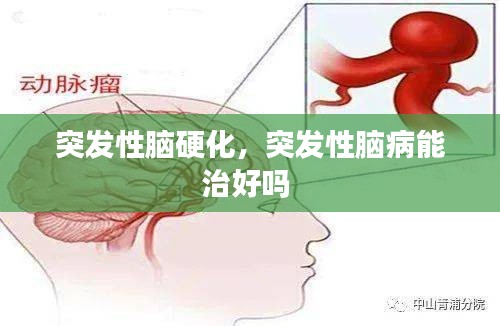 突發(fā)性腦硬化，突發(fā)性腦病能治好嗎 